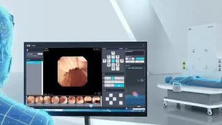 十堰东大肛肠医院：胃镜检查很重要，这几类人尤其有必要做！