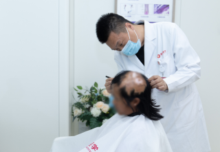 六个月大“帽子姑娘”滚入火堆 25年后疤痕植发焕发新生